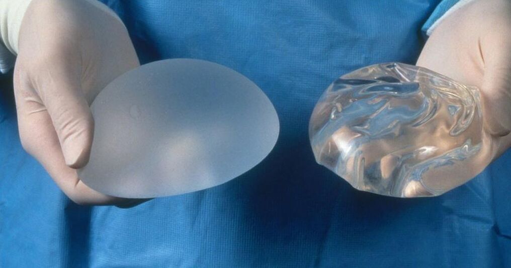 implant